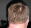 Back - Before