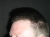 Left - After