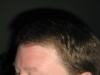 Left - Before