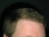 Right - Before